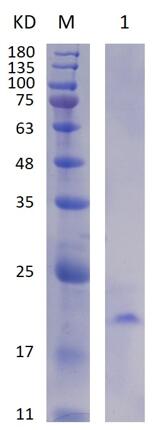 12% SDS-PAGE analysis profiles of purified MCR_RS04675-22-96 (CBB stained).